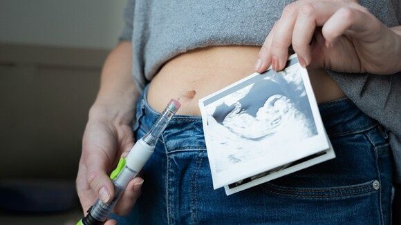 ��� ������ �������� ����� �����������